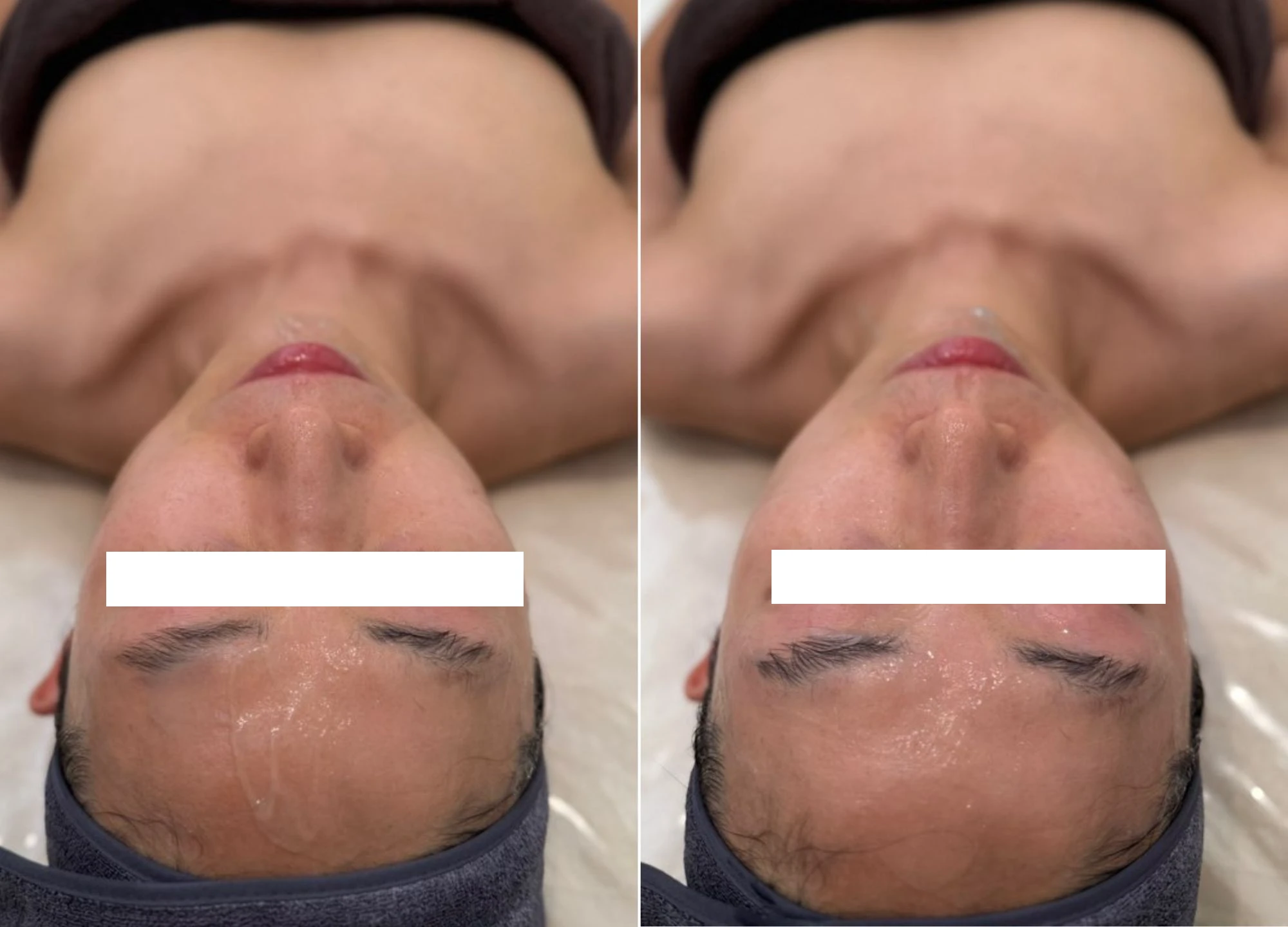 청라 피부관리샵 추천 – 나를봄 스킨앤바디 수분관리 후기